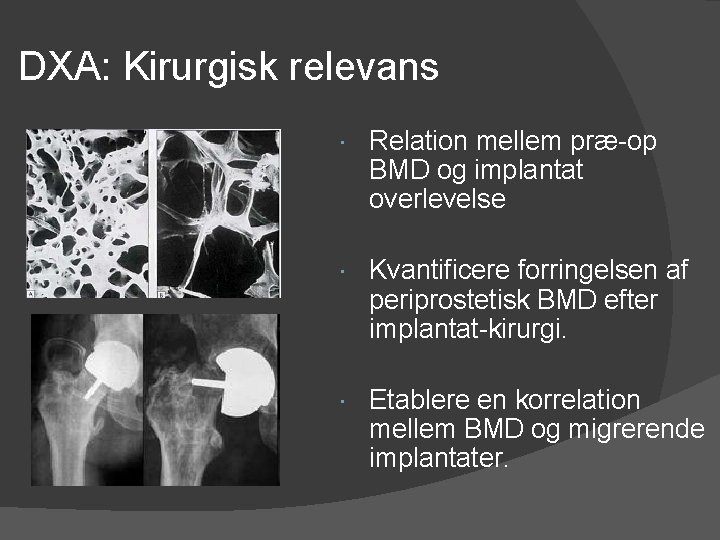 DXA: Kirurgisk relevans Relation mellem præ-op BMD og implantat overlevelse Kvantificere forringelsen af periprostetisk