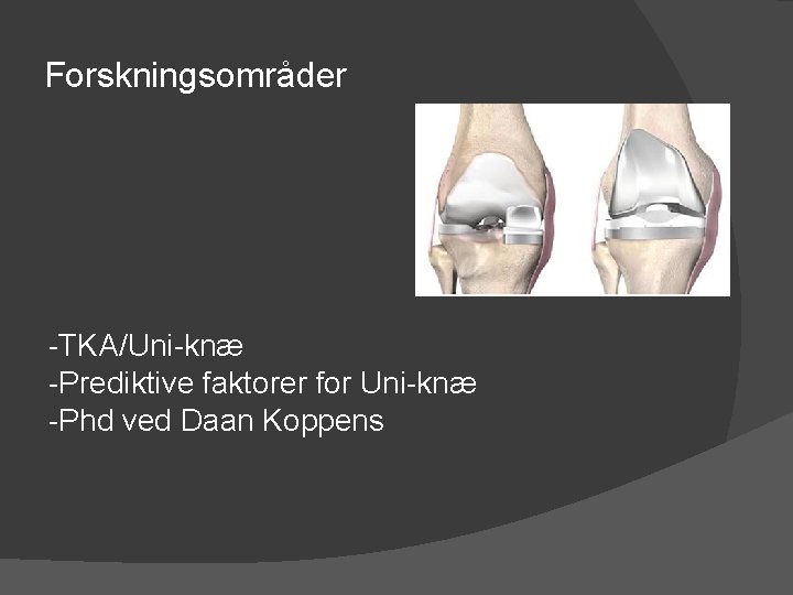 Forskningsområder -TKA/Uni-knæ -Prediktive faktorer for Uni-knæ -Phd ved Daan Koppens 