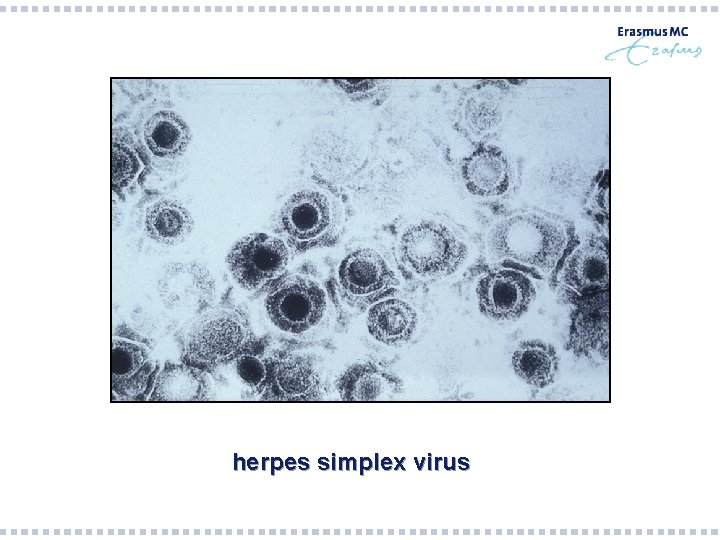 herpes simplex virus herpes simplex virus