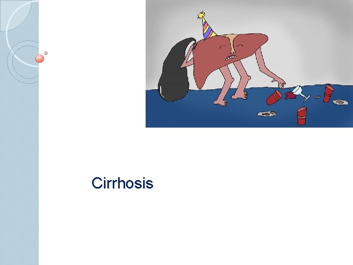 Cirrhosis 