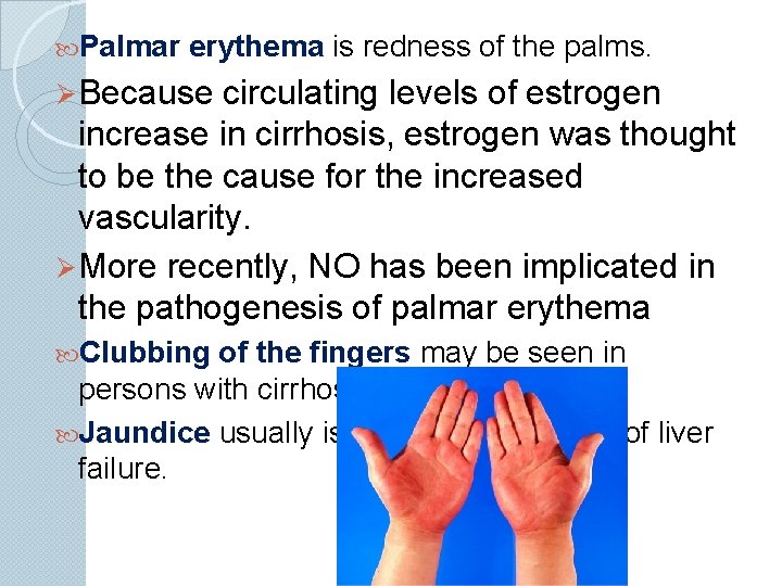  Palmar erythema is redness of the palms. Ø Because circulating levels of estrogen