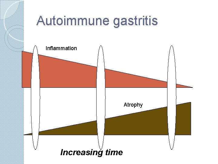 Autoimmune gastritis Inflammation Atrophy Increasing time 