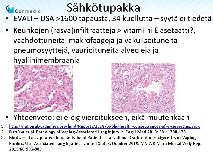 Sähkötupakka • EVALI – USA >1600 tapausta, 34 kuollutta – syytä ei tiedetä •