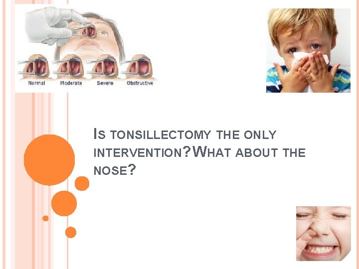 IS TONSILLECTOMY THE ONLY INTERVENTION? WHAT ABOUT THE NOSE? 