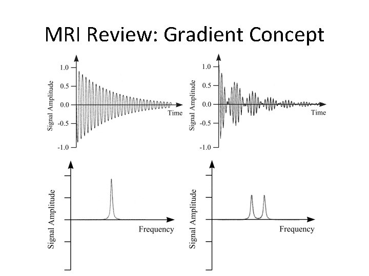 MRI Review: Gradient Concept 