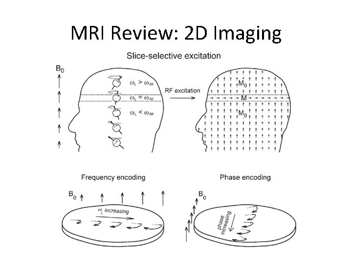 MRI Review: 2 D Imaging 