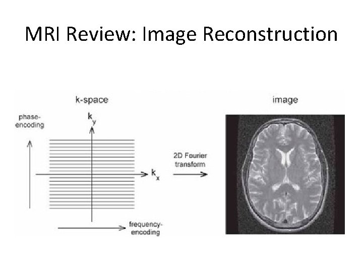MRI Review: Image Reconstruction 