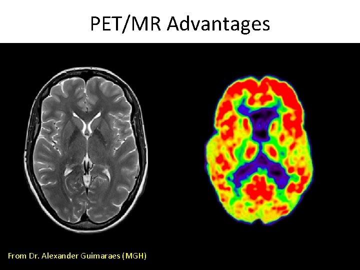 PET/MR Advantages From Dr. Alexander Guimaraes (MGH) 