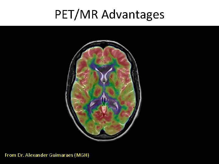 PET/MR Advantages From Dr. Alexander Guimaraes (MGH) 