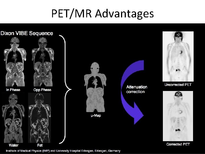 PET/MR Advantages 