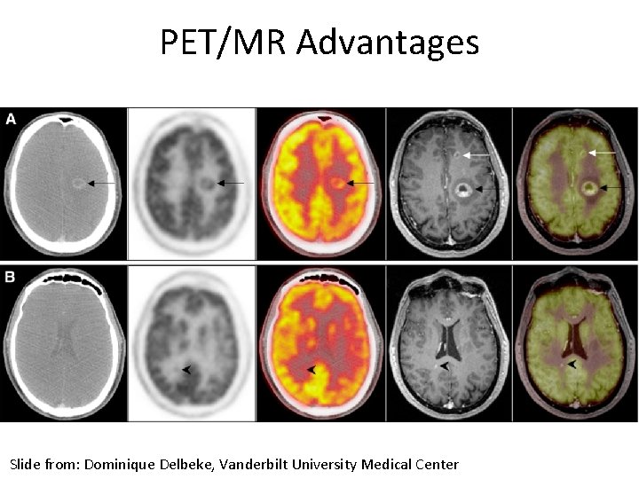 PET/MR Advantages Slide from: Dominique Delbeke, Vanderbilt University Medical Center 
