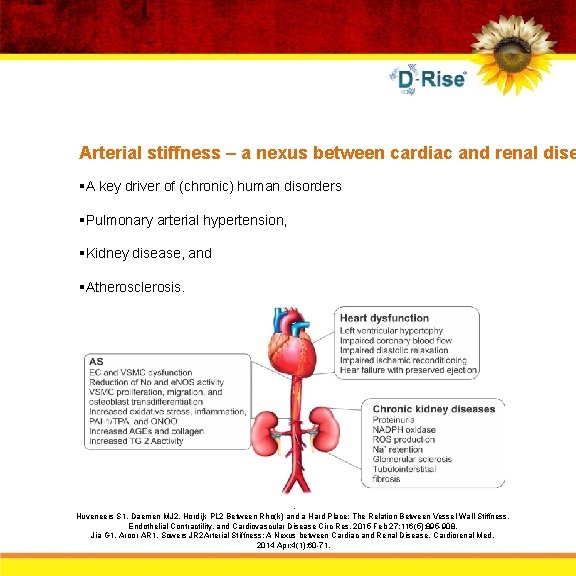 Arterial stiffness – a nexus between cardiac and renal dise §A key driver of