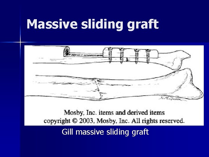 Massive sliding graft Gill massive sliding graft 