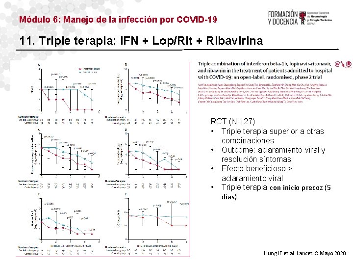 Módulo 6: Manejo de la infección por COVID-19 11. Triple terapia: IFN + Lop/Rit