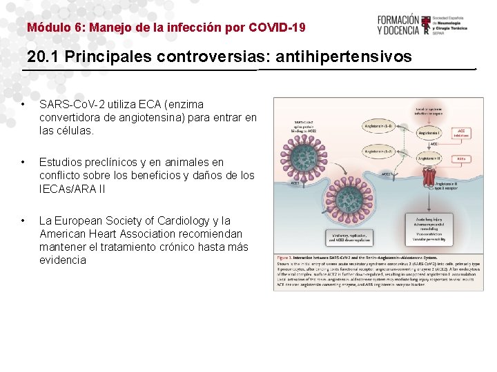 Módulo 6: Manejo de la infección por COVID-19 20. 1 Principales controversias: antihipertensivos •