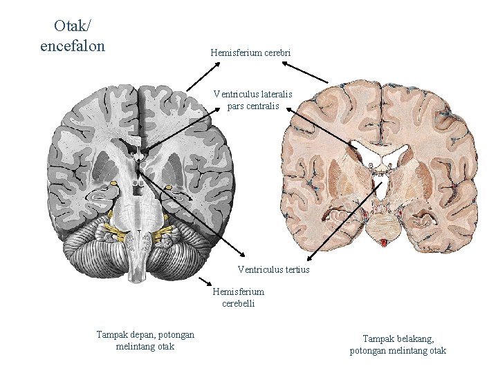 Otak/ encefalon Hemisferium cerebri Ventriculus lateralis pars centralis Ventriculus tertius Hemisferium cerebelli Tampak depan,