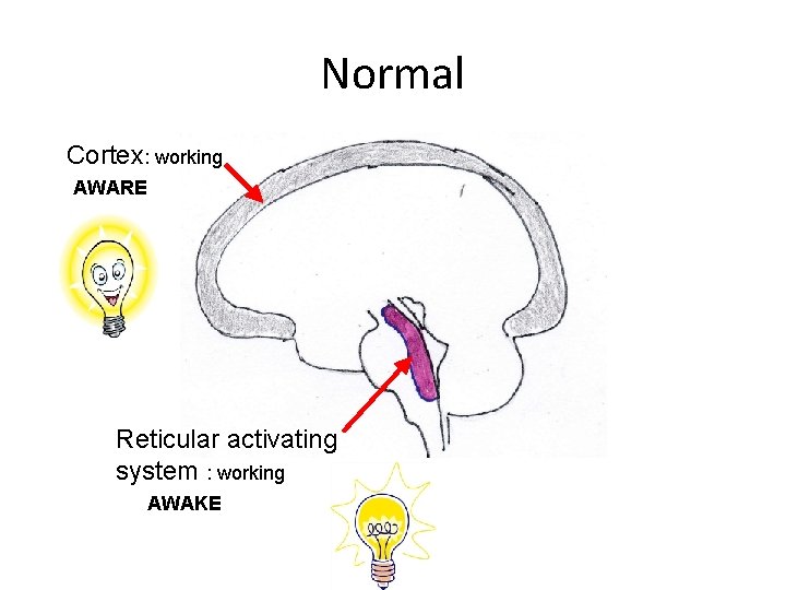 Normal Cortex: working AWARE Reticular activating system : working AWAKE 