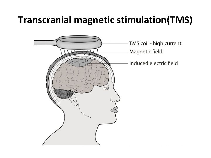 Transcranial magnetic stimulation(TMS) Transcranial magnetic stimulation(TMS)