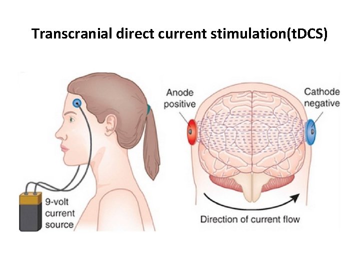 Transcranial direct current stimulation(t. DCS) 