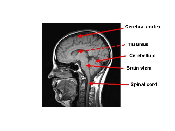 Cerebral cortex Thalamus Cerebellum Brain stem Spinal cord 