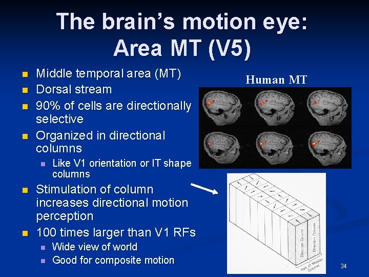 The brain’s motion eye: Area MT (V 5) n n Middle temporal area (MT)