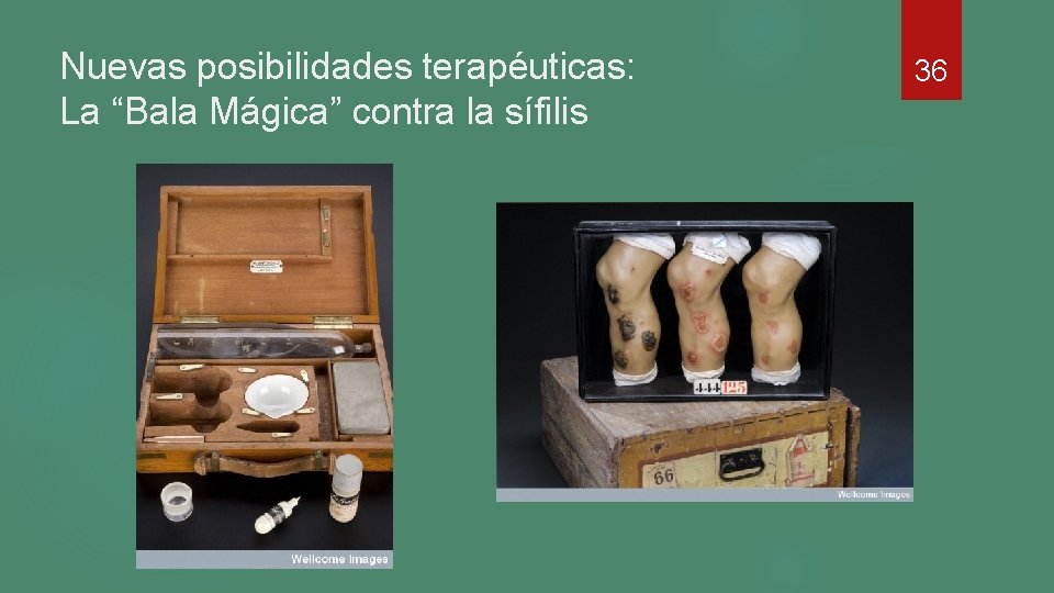 Nuevas posibilidades terapéuticas: La “Bala Mágica” contra la sífilis 36 Nuevas posibilidades terapéuticas: La “Bala Mágica” contra la sífilis 36