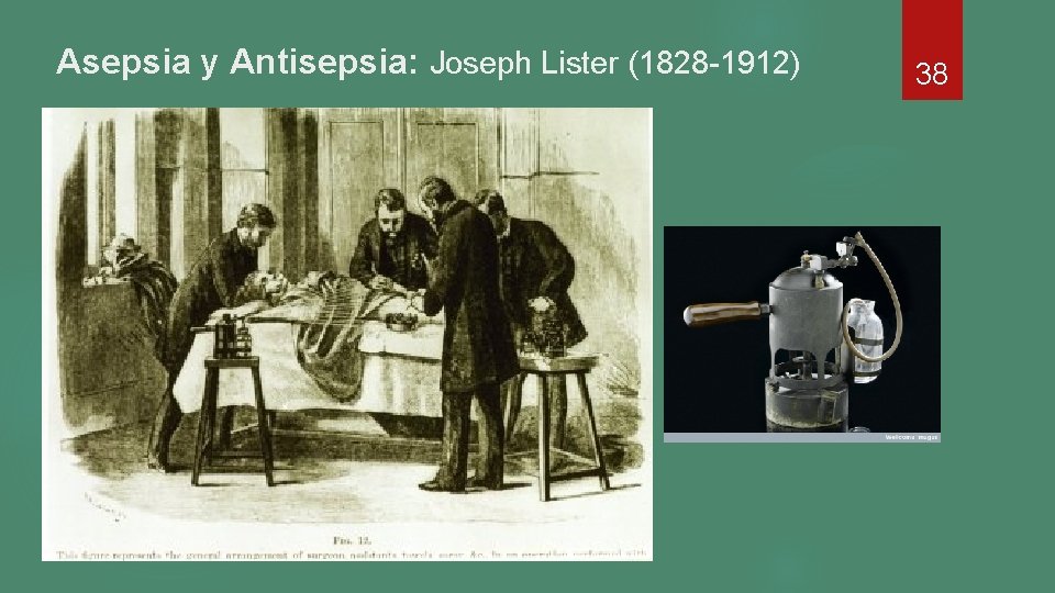 Asepsia y Antisepsia: Joseph Lister (1828 -1912) 38 Asepsia y Antisepsia: Joseph Lister (1828 -1912) 38