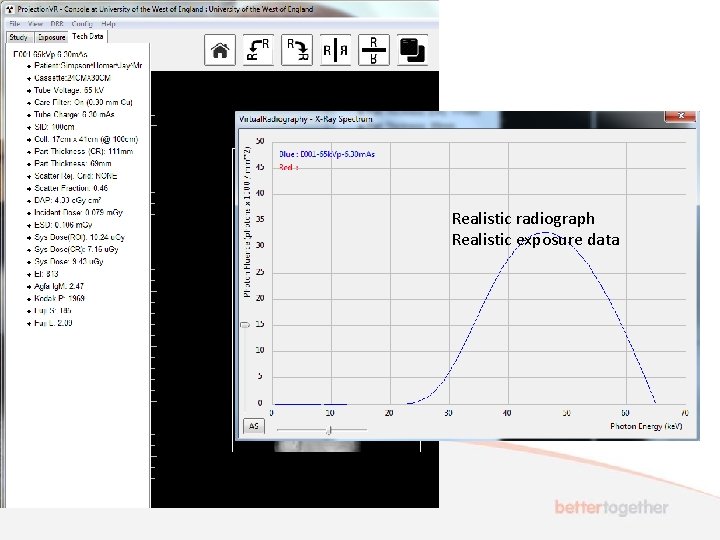 Realistic radiograph Realistic exposure data 