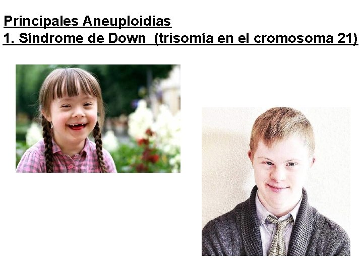 Principales Aneuploidias 1. Síndrome de Down (trisomía en el cromosoma 21) 