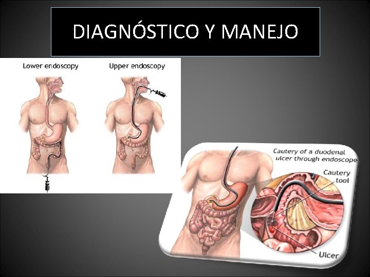 DIAGNÓSTICO Y MANEJO DIAGNÓSTICO Y MANEJO