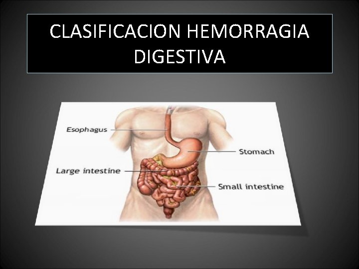 CLASIFICACION HEMORRAGIA DIGESTIVA CLASIFICACION HEMORRAGIA DIGESTIVA