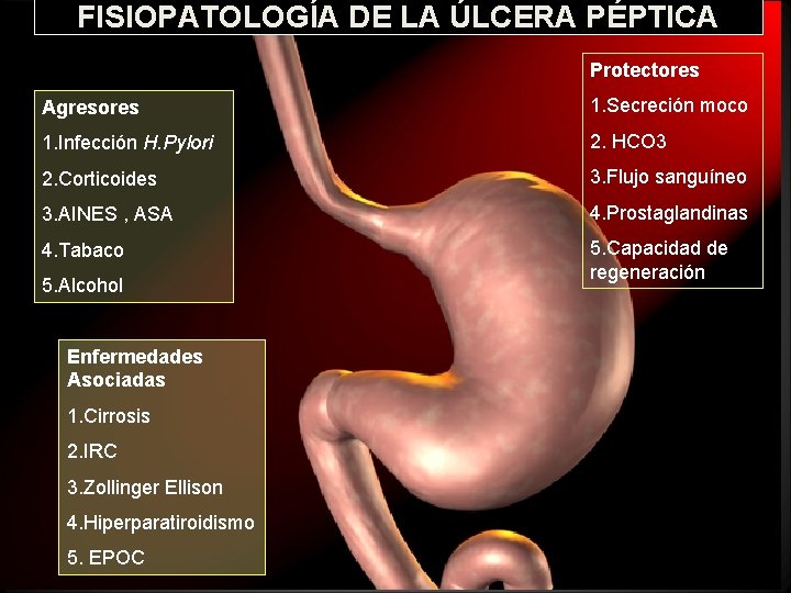 FISIOPATOLOGÍA DE LA ÚLCERA PÉPTICA Protectores Agresores 1. Secreción moco 1. Infección H. Pylori FISIOPATOLOGÍA DE LA ÚLCERA PÉPTICA Protectores Agresores 1. Secreción moco 1. Infección H. Pylori