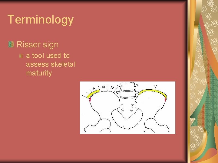 Terminology Risser sign a tool used to assess skeletal maturity Terminology Risser sign a tool used to assess skeletal maturity