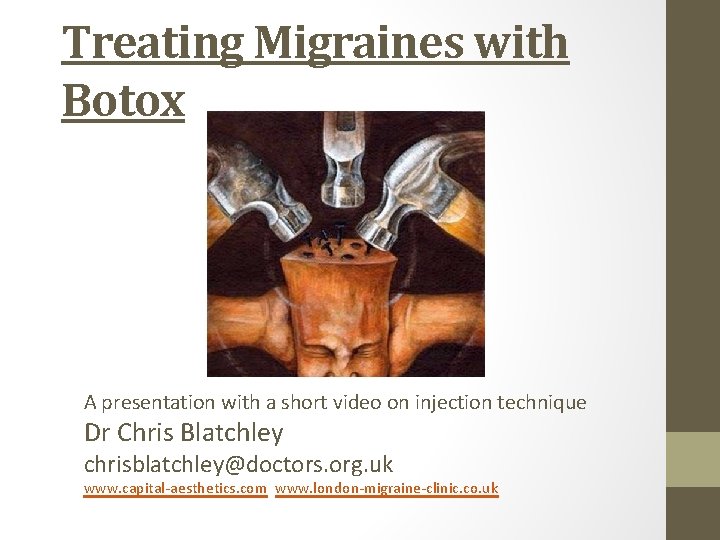 Treating Migraines with Botox A presentation with a short video on injection technique Dr