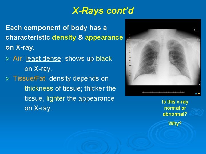 X-Rays cont’d Each component of body has a characteristic density & appearance on X-ray.