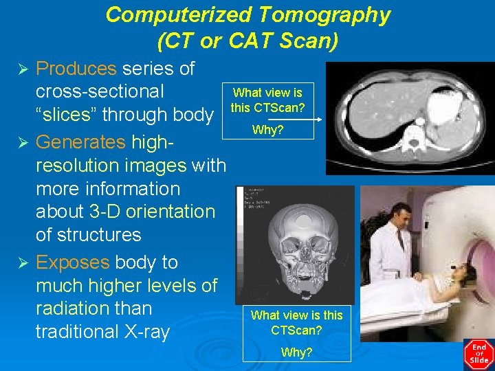 Computerized Tomography (CT or CAT Scan) Produces series of What view is cross-sectional this