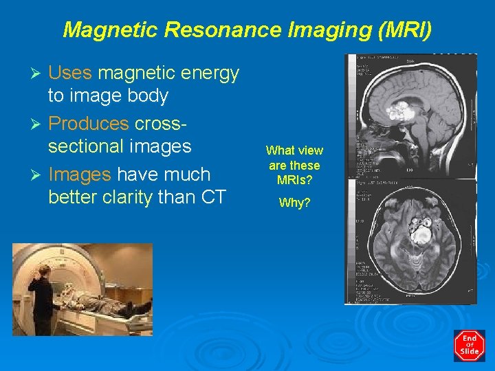 Magnetic Resonance Imaging (MRI) Uses magnetic energy to image body Ø Produces crosssectional images