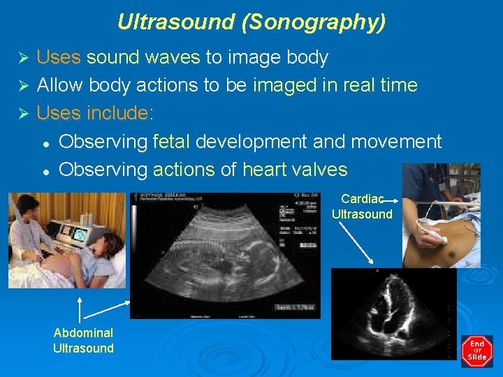 Ultrasound (Sonography) Uses sound waves to image body Ø Allow body actions to be