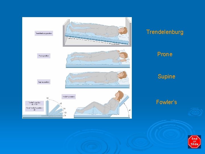 Trendelenburg Prone Supine Fowler’s 