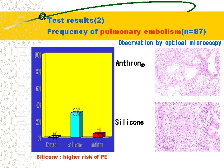 Test results(2) Frequency of pulmonary embolism(n=87) Observation by optical microscopy Anthron Silicone : higher