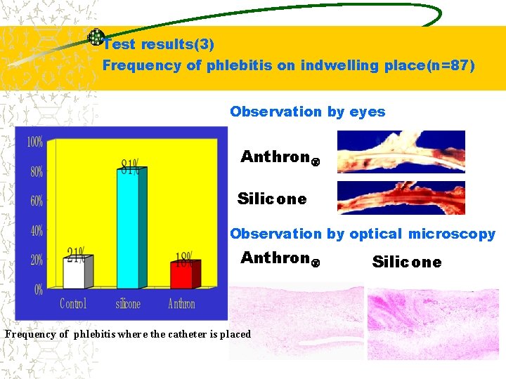 Test results(3) Frequency of phlebitis on indwelling place(n=87) Observation by eyes　　 Anthron Silicone Observation
