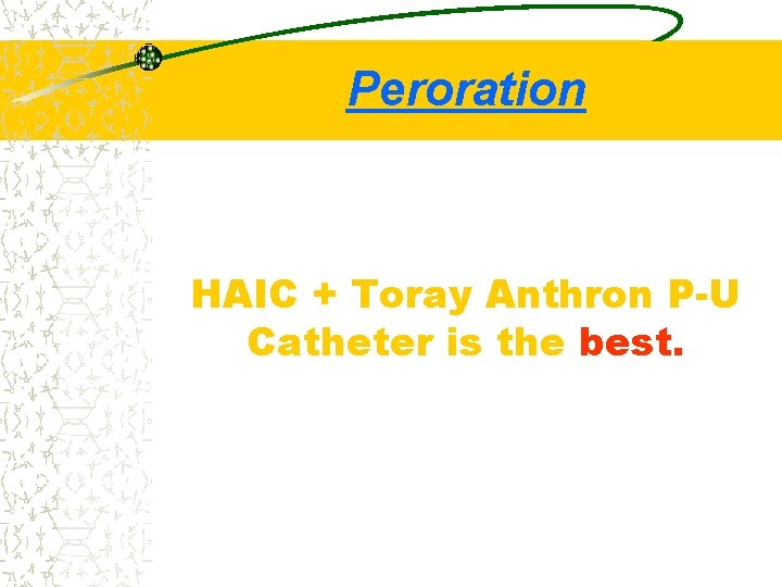 Peroration HAIC + Toray Anthron P-U Catheter is the best. 