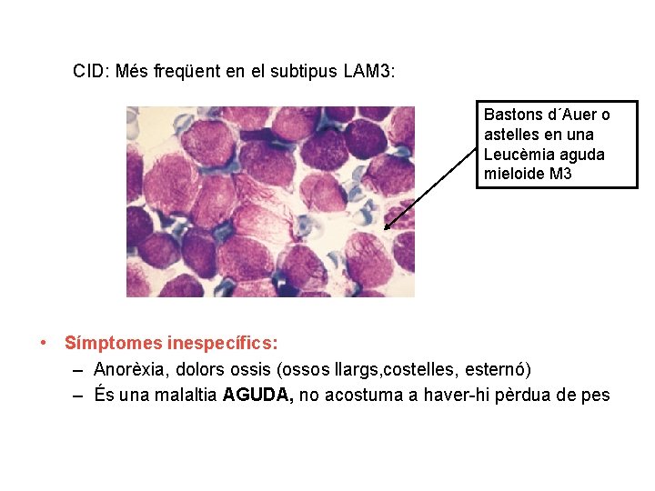 CID: Més freqüent en el subtipus LAM 3: Bastons d´Auer o astelles en una