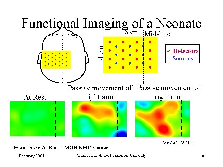 Functional Imaging of a Neonate 4 cm 6 cm Mid-line At Rest Passive movement