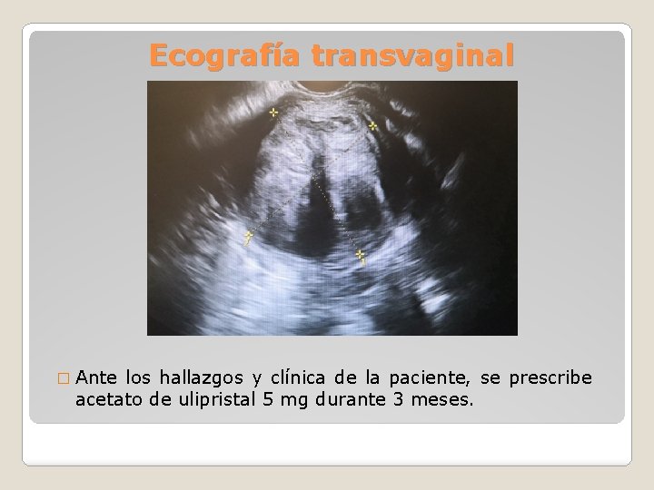 Ecografía transvaginal � Ante los hallazgos y clínica de la paciente, se prescribe acetato