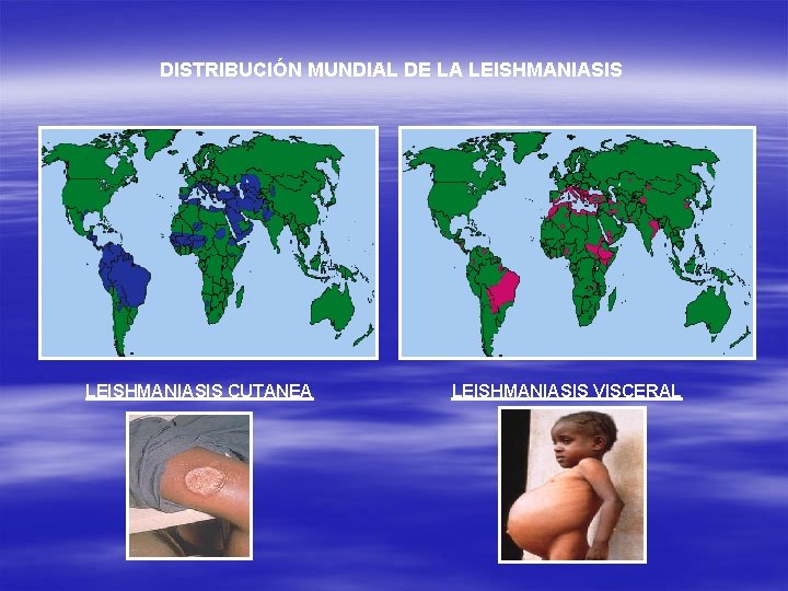 DISTRIBUCIÓN MUNDIAL DE LA LEISHMANIASIS CUTANEA LEISHMANIASIS VISCERAL 