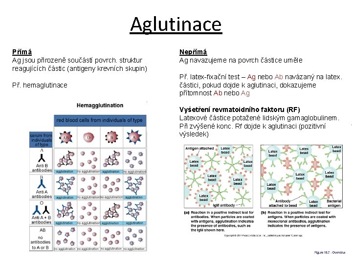 Aglutinace Přímá Ag jsou přirozeně součástí povrch. struktur reagujících částic (antigeny krevních skupin) Př.