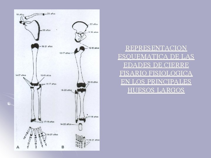 REPRESENTACION ESQUEMATICA DE LAS EDADES DE CIERRE FISARIO FISIOLOGICA EN LOS PRINCIPALES HUESOS LARGOS