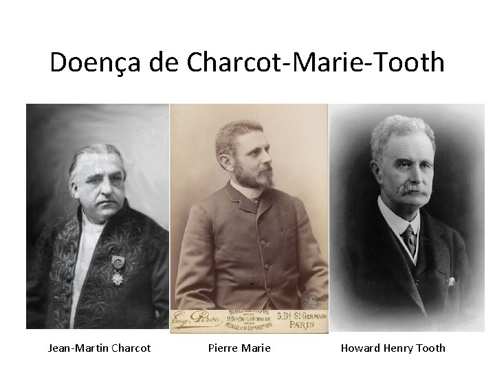 Doença de Charcot-Marie-Tooth Jean-Martin Charcot Pierre Marie Howard Henry Tooth 