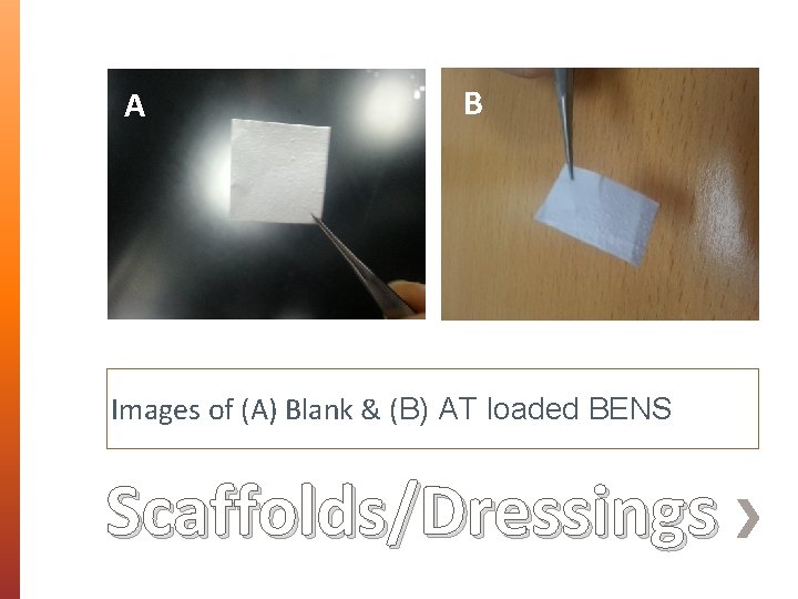 A B Images of (A) Blank & (B) AT loaded BENS Scaffolds/Dressings 